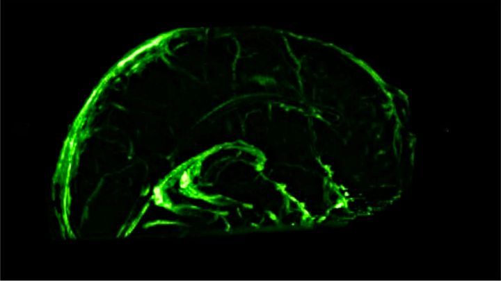 Surprendre! Les scientifiques découvrent que le cerveau humain possède un système lymphatique.